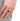 Diabetes Management Ring - Blood Sugar Control Accessory - DecorOfficial