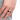 Diabetes Management Ring - Blood Sugar Control Accessory - DecorOfficial